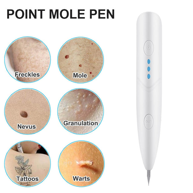Laser Plasma Removal Pen